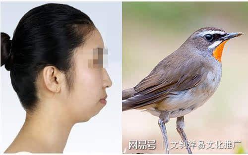 小鸟嘴面相是啥样的 人长小鸟嘴图片大全
