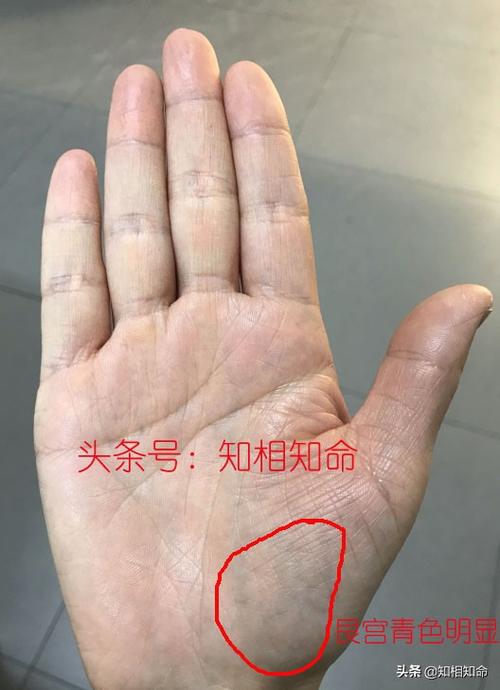 艮宫手相分析男人婚姻运势 手相中艮宫竖纹多的人